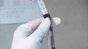 Luanda com falta de medicamentos para redução dos efeitos do HIV sida no homem